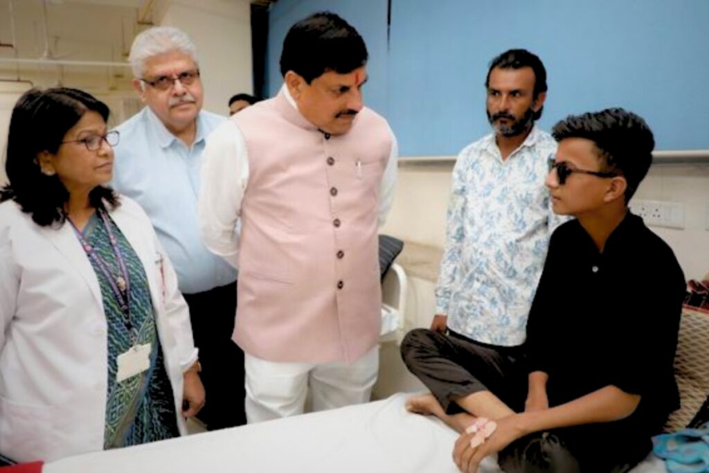 CM Mohan Yadav Visited patients who lost their eyes due to calcium carbide gun
