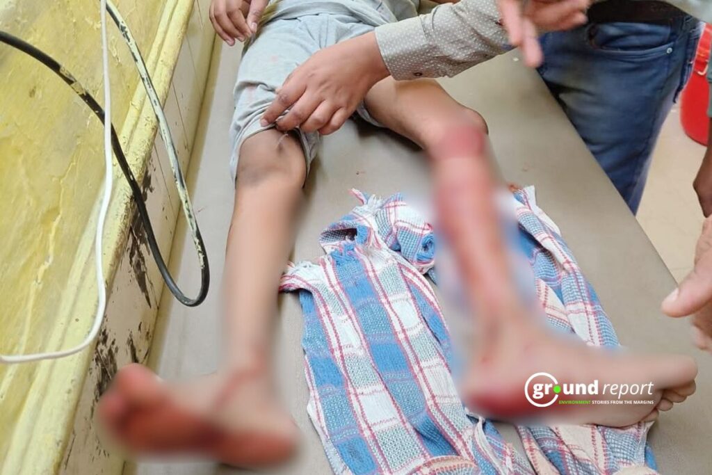 monkey attack in rajgarh district of MP