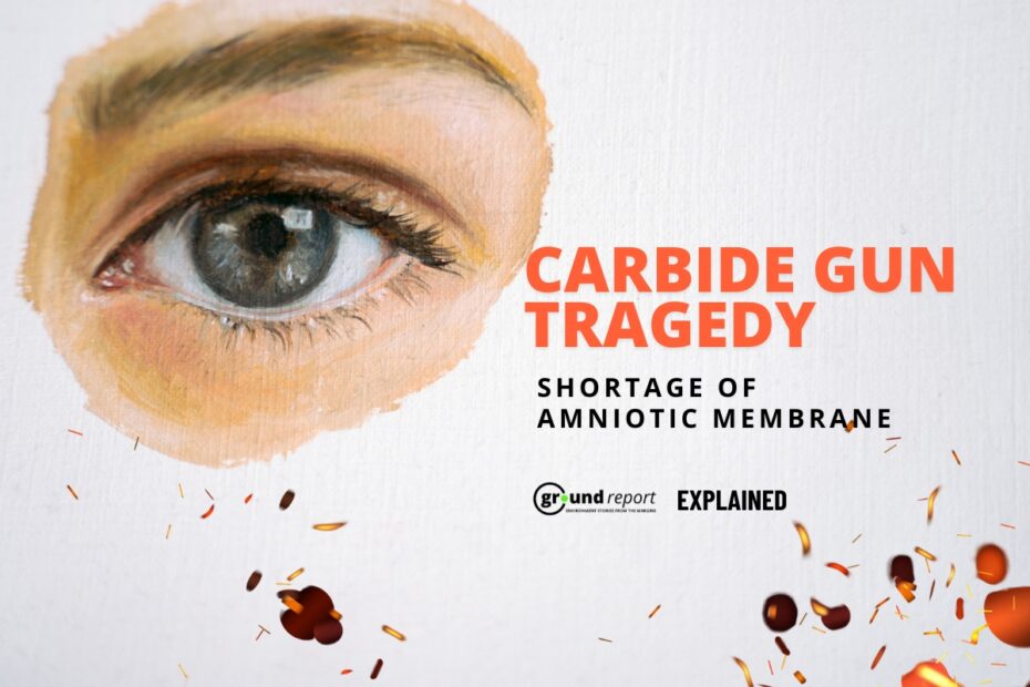 Amniotic membrane Shortage in Carbide Gun Accident Case
