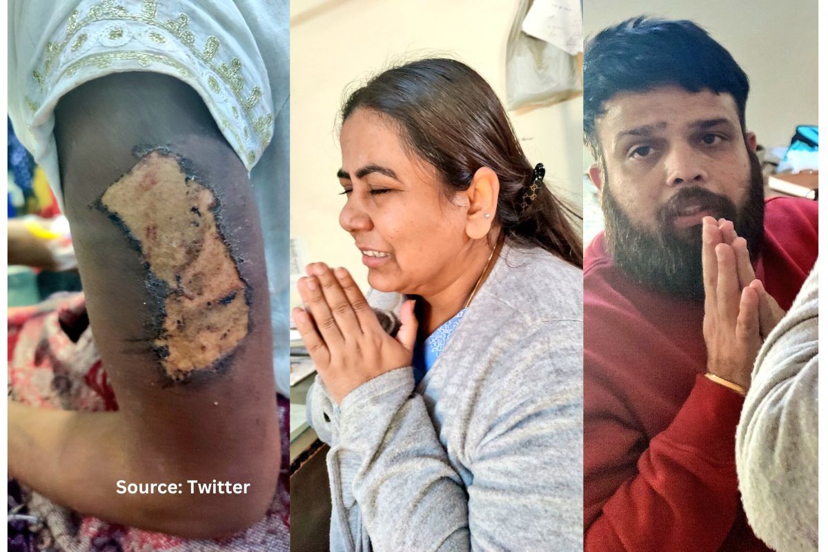 Minor girl hired as help brutalised, tortured by couple in Gurugram, held