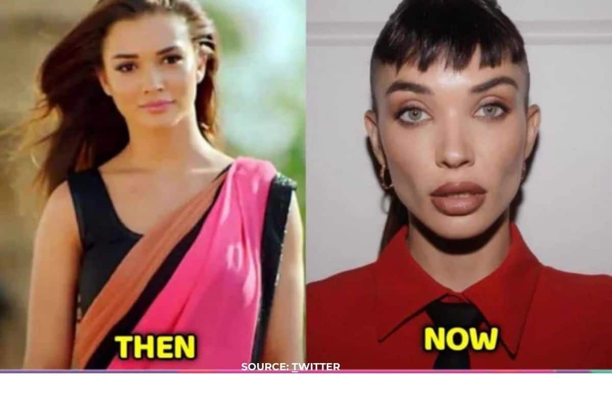 How did Amy Jackson's face change so much?