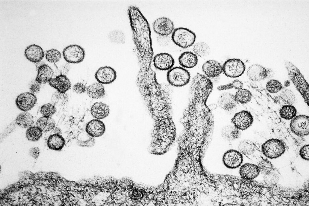 Hantavirus-pulmonary-syndrome, Microscopic view, Credit: Cynthia Goldsmith, US