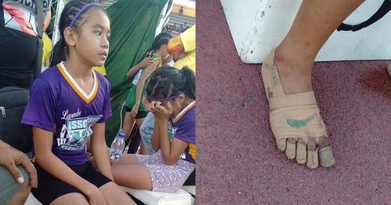 Who is Rhea Bullos, How she won 3 race with just Bandages on Feet