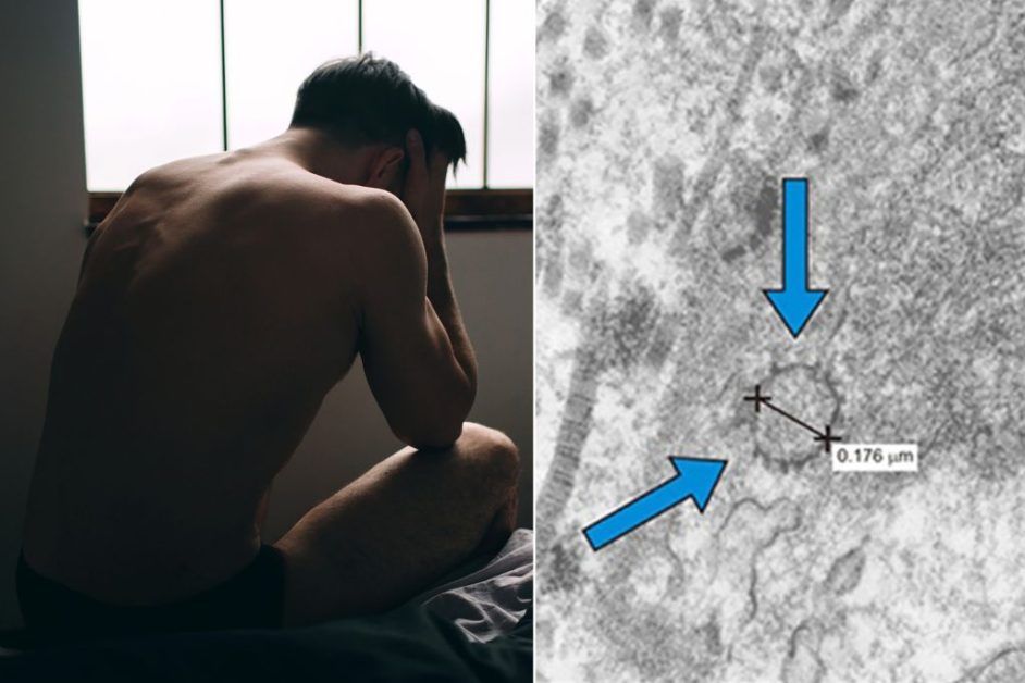 Man lost 1.5 inches from the length of his genital after Covid