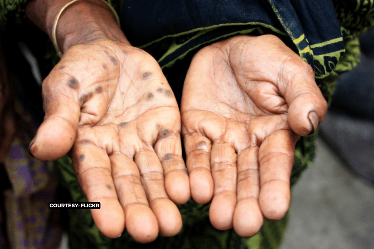 Carcinogenic arsenic in water: 50 million at risk in rural India