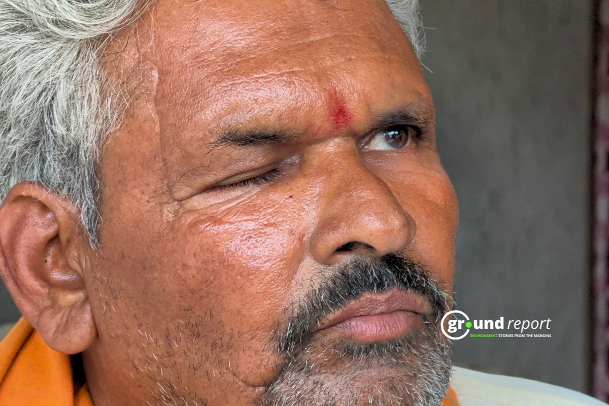 Balakram shows the scars of a near-fatal tiger attack in Pench Tiger Reserve that left him unable to open one eye.