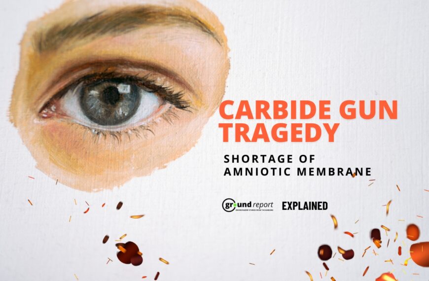 Amniotic membrane Shortage in Carbide Gun Accident Case
