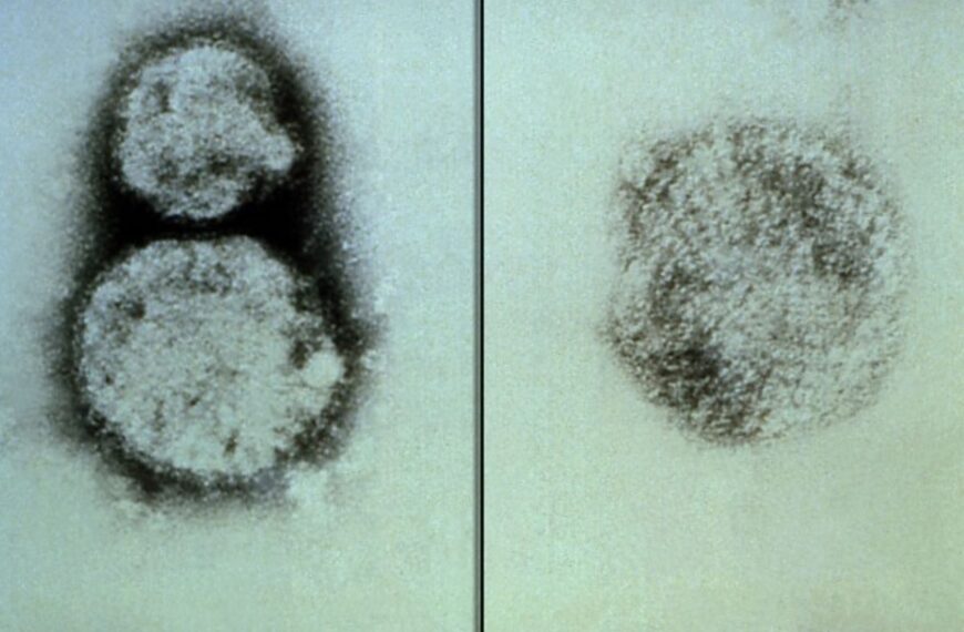 Hantavirus Explained: What It Is, How It Kills, and Why India Is at Risk