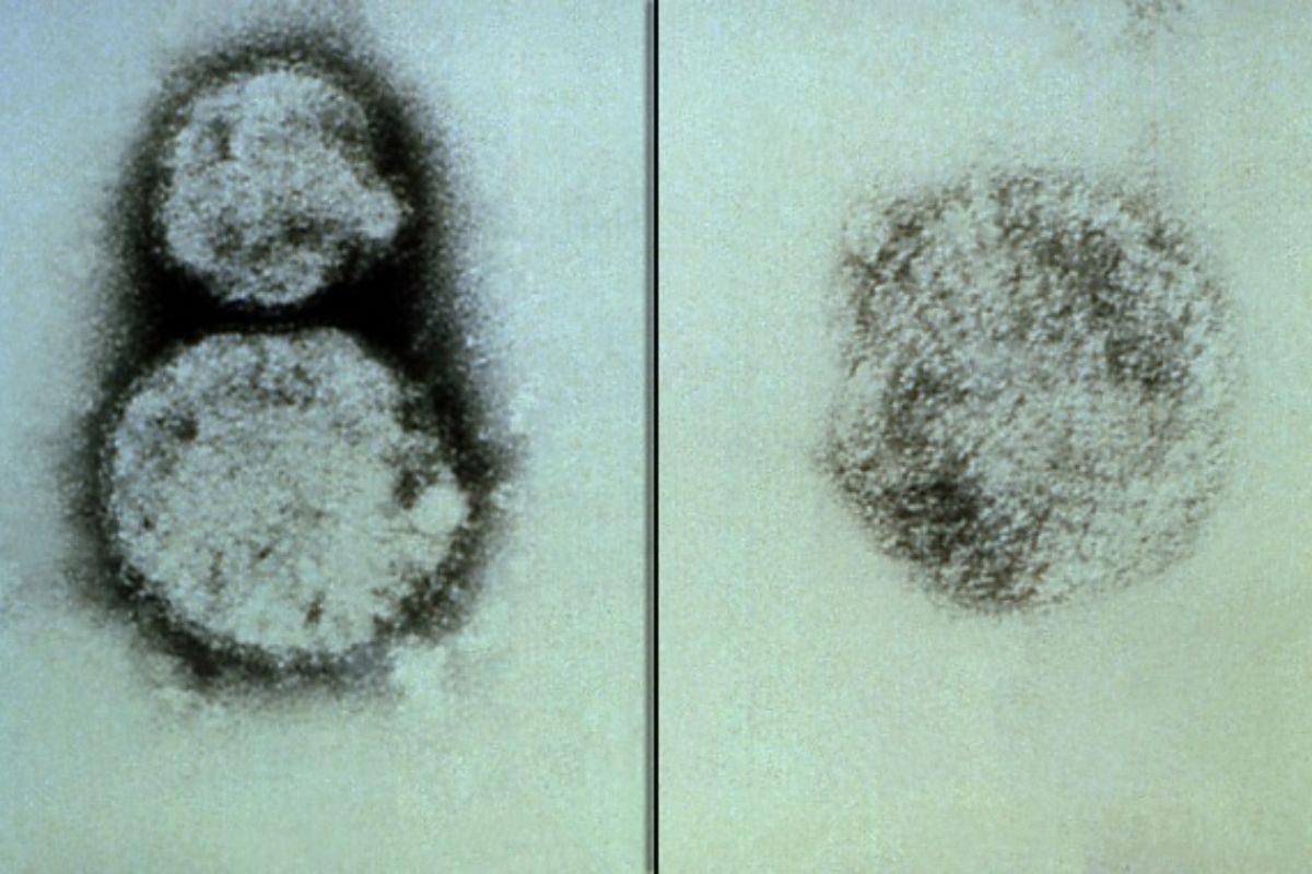 Hantavirus Explained: What It Is, How It Kills, and Why India Is at Risk